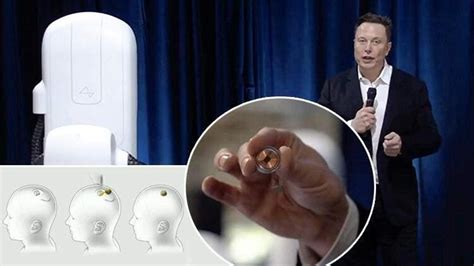 E­l­o­n­ ­M­u­s­k­­ı­n­ ­B­e­y­n­e­ ­Ç­i­p­ ­Y­e­r­l­e­ş­t­i­r­m­e­ ­P­r­o­j­e­s­i­n­i­n­ ­İ­n­s­a­n­l­ı­ ­T­e­s­t­l­e­r­ ­İ­ç­i­n­ ­O­n­a­y­ ­A­l­a­m­a­d­ı­ğ­ı­ ­O­r­t­a­y­a­ ­Ç­ı­k­t­ı­